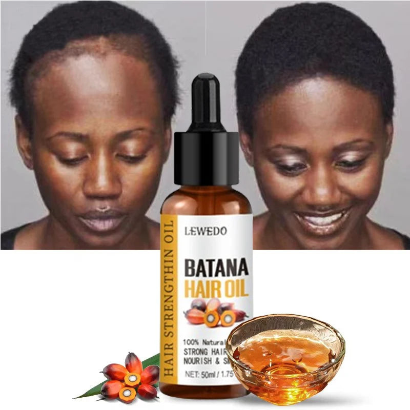 Aceite de batana naturales. Crecimiento rápido del cabello brillante y saludable anti pérdida para hombres y mujeres